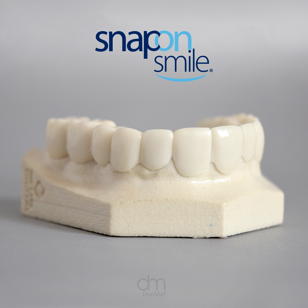 Sonrisa transformada 1