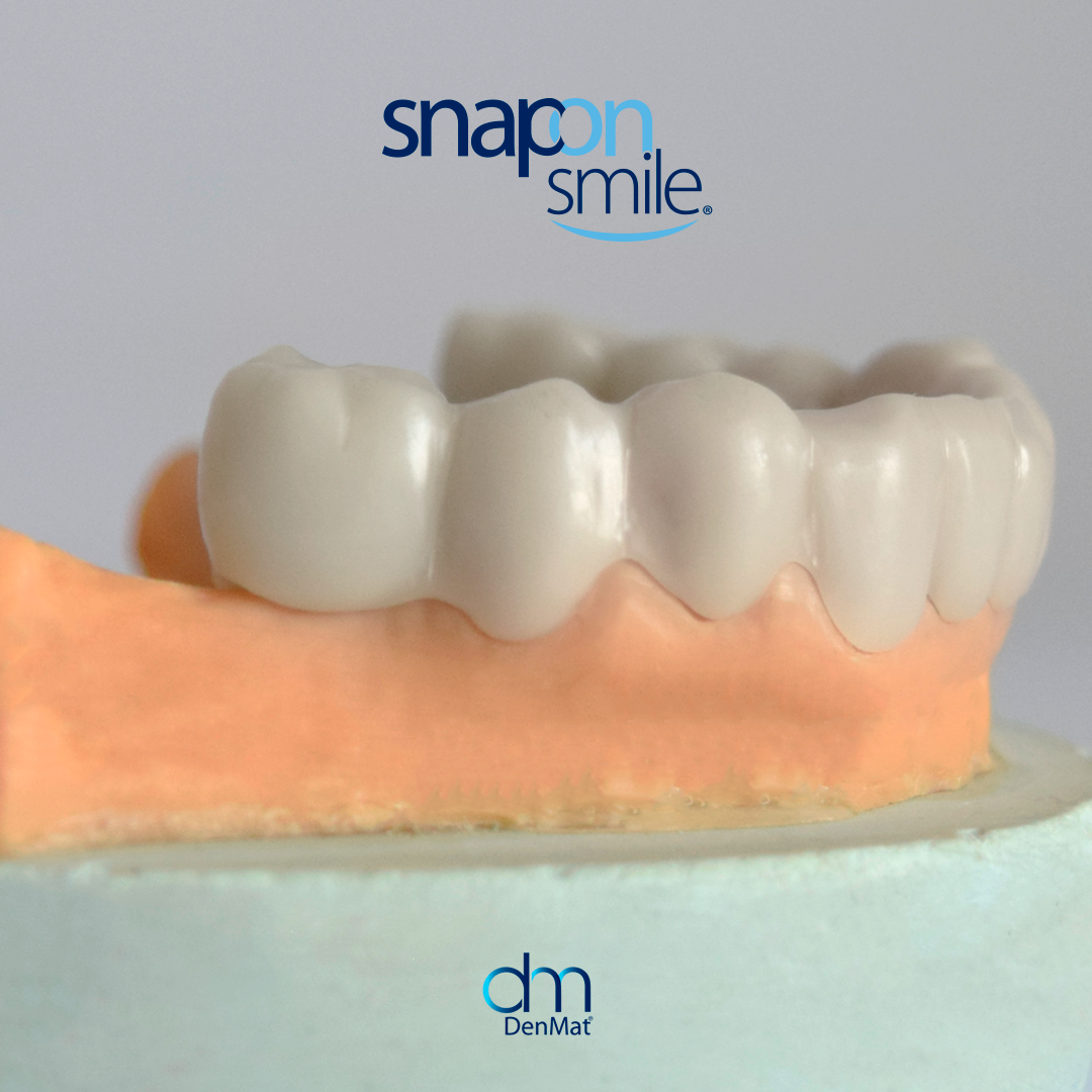 Sonrisa transformada 5